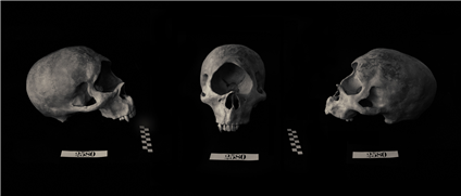Skull