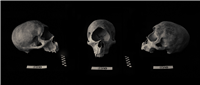 Skull